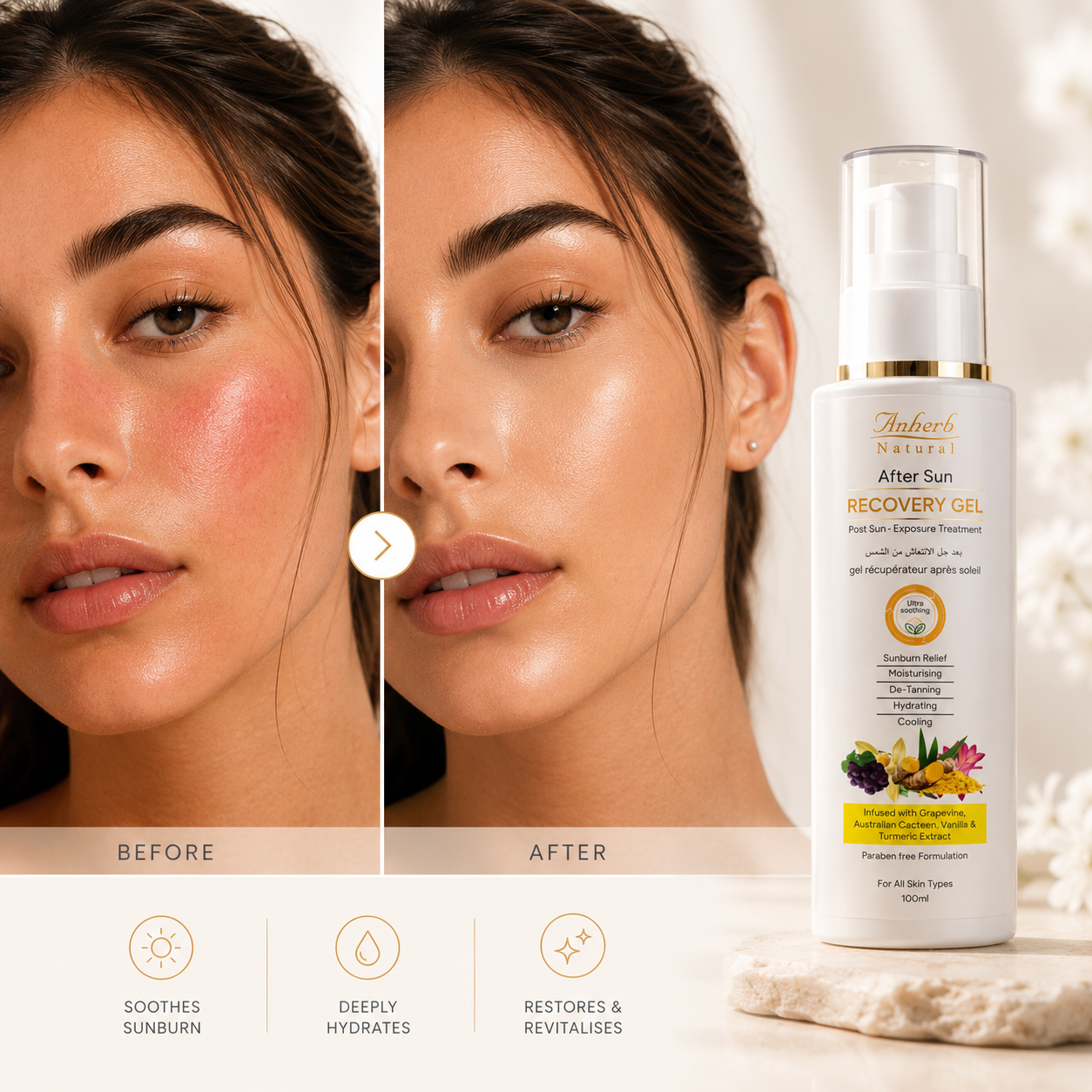 Anherb After Sun Recovery Gel